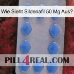 Wie Sieht Sildenafil 50 Mg Ausk 21